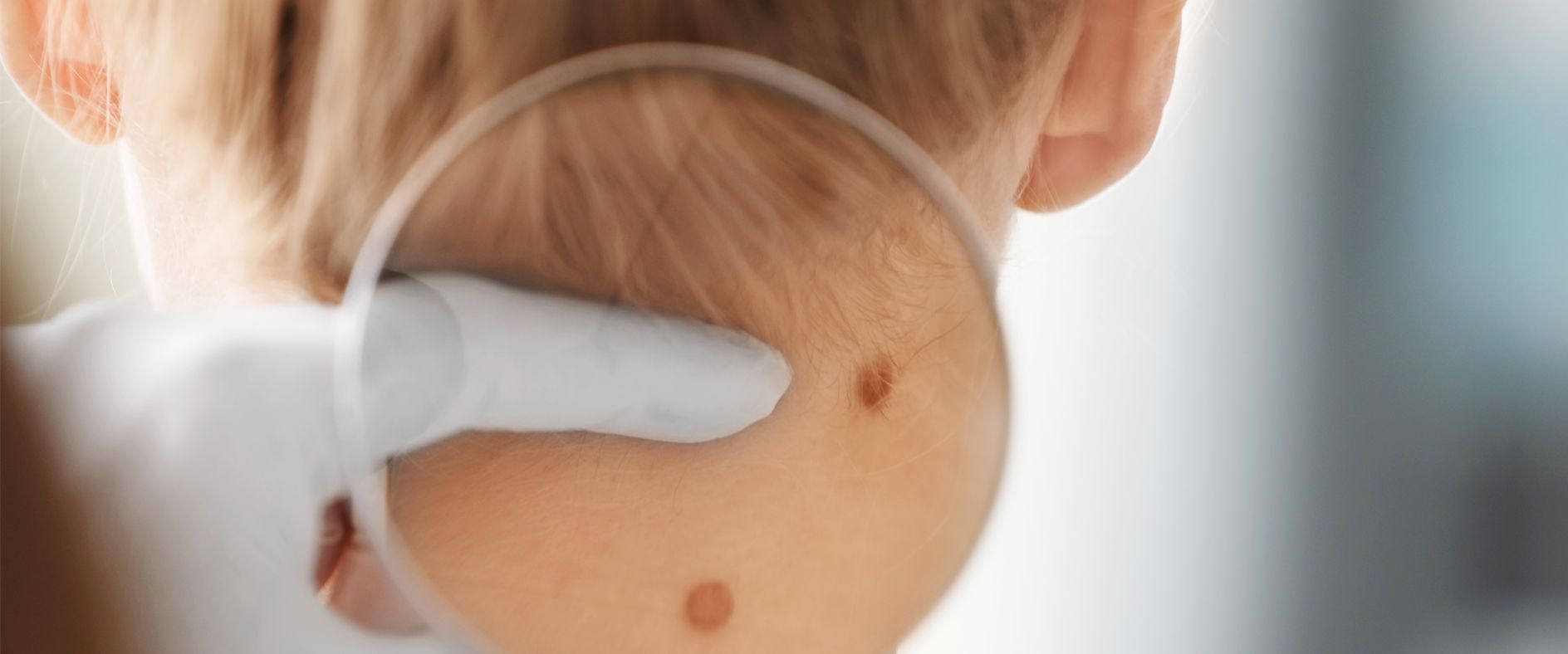 Chirurgische Hautkrebsbehandlung (Dermatochirurgie) - FAZ